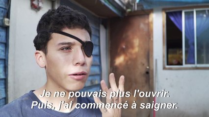 Eborgnés, ils portent les marques indélébiles des troubles au Chili