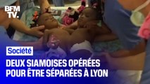 Bissie et Eyenga, deux siamoises camerounaises, ont été séparées à Lyon ce mercredi