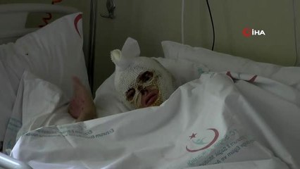 Tüp patlaması sonucu yanan kadın 2 aydır iyileşeceği günü bekliyor