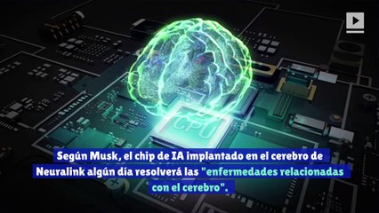Elon Musk piensa que los chips cerebrales con inteligencia artificial podrían "resolver" el autismo y la esquizofrenia