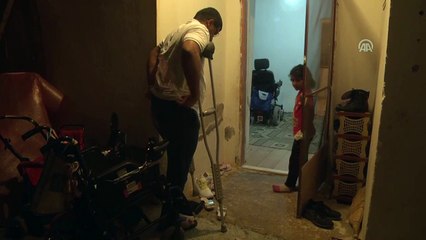 Protez bacağına kavuşacağı günü heyecanla bekliyor - ANTALYA