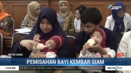 Pascaoperasi Pemisahan, Bayi Kembar Siam Aqila-Azila Diperbolehkan Pulang ke Kendari