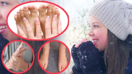 Download Video: सर्दियों में उंगलियों की सूजन दूर करेंगे ये घरेलू उपाय | Finger Swelling remedies in Winter |Boldsky