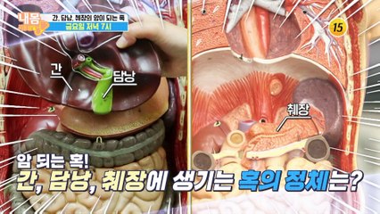 간, 담낭, 췌장의 암이 되는 혹_내 몸 사용설명서 277회 예고