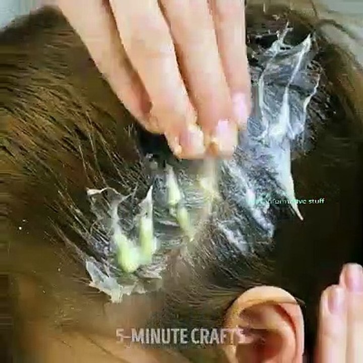 10 Benefits of Aloe vera