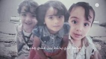 حكاية سورية تتكرر منذ ثمان داميات من السنين..حكاية اطفال قتلتهم الطائرات الروسية والوحشية الأسدية