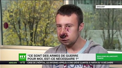 Gilets jaunes acte 53 : le témoignage glaçant d'un journaliste touché au visage