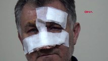 Kayseri park kavgasında komşusunun burnunu kırdı