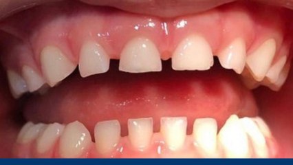 bd-ortodoncia-niños-y-adolescentes-191119