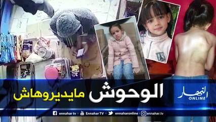 فيديو لعملية سطو على تبرعات محسنين موجهة لعلاج طفلة مريضة في العمود الفقري