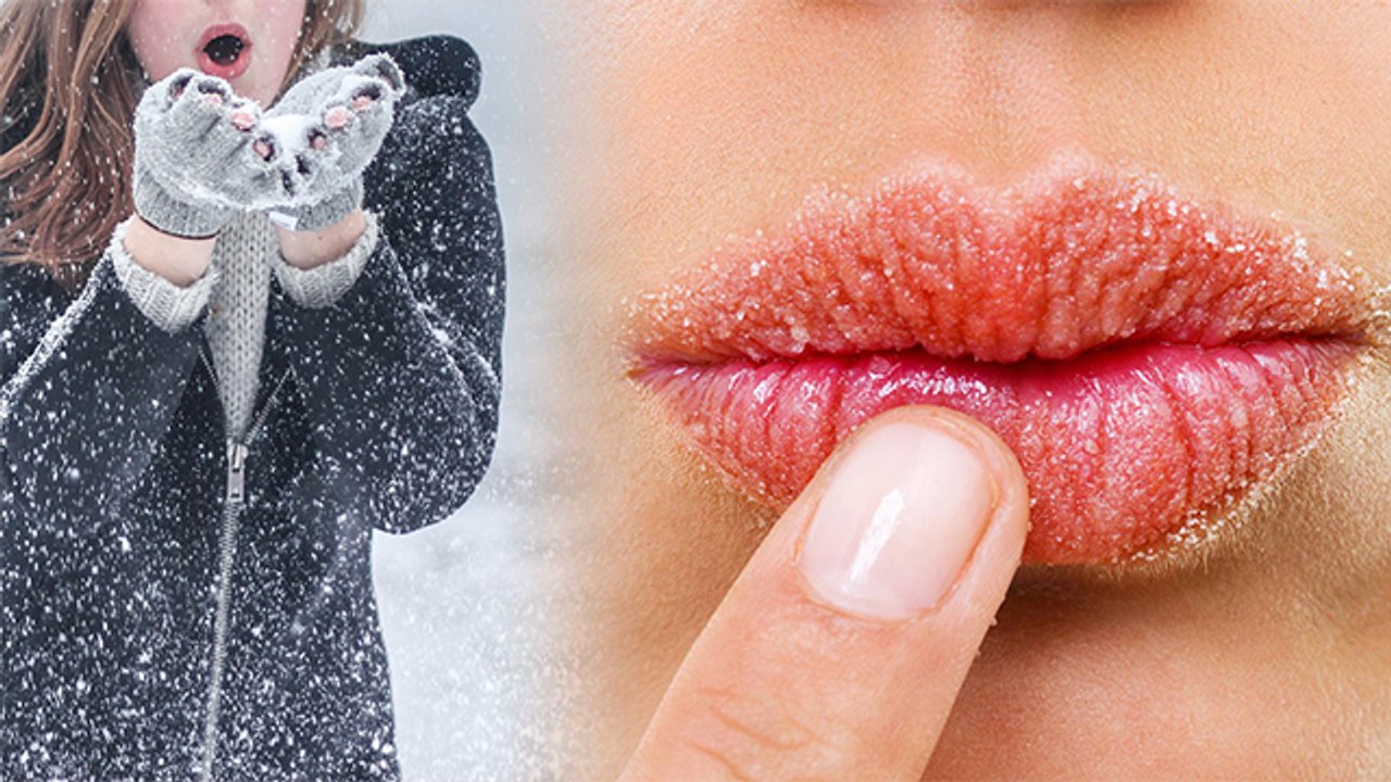 Winter Lip Care Tips | Home Remedies | सर्दियों...