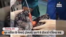 व्यक्ति ने 30 साल रोजाना सिगरेट पी, दोनों फेफड़े काले पड़े; ट्रांसप्लांट नहीं हो सके