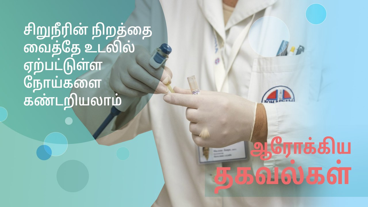 சிறுநீரின் நிறத்தை வைத்து உடலில் ஏற்பட்டுள்ள நோய்களை எப்படி கண்டறிவது?