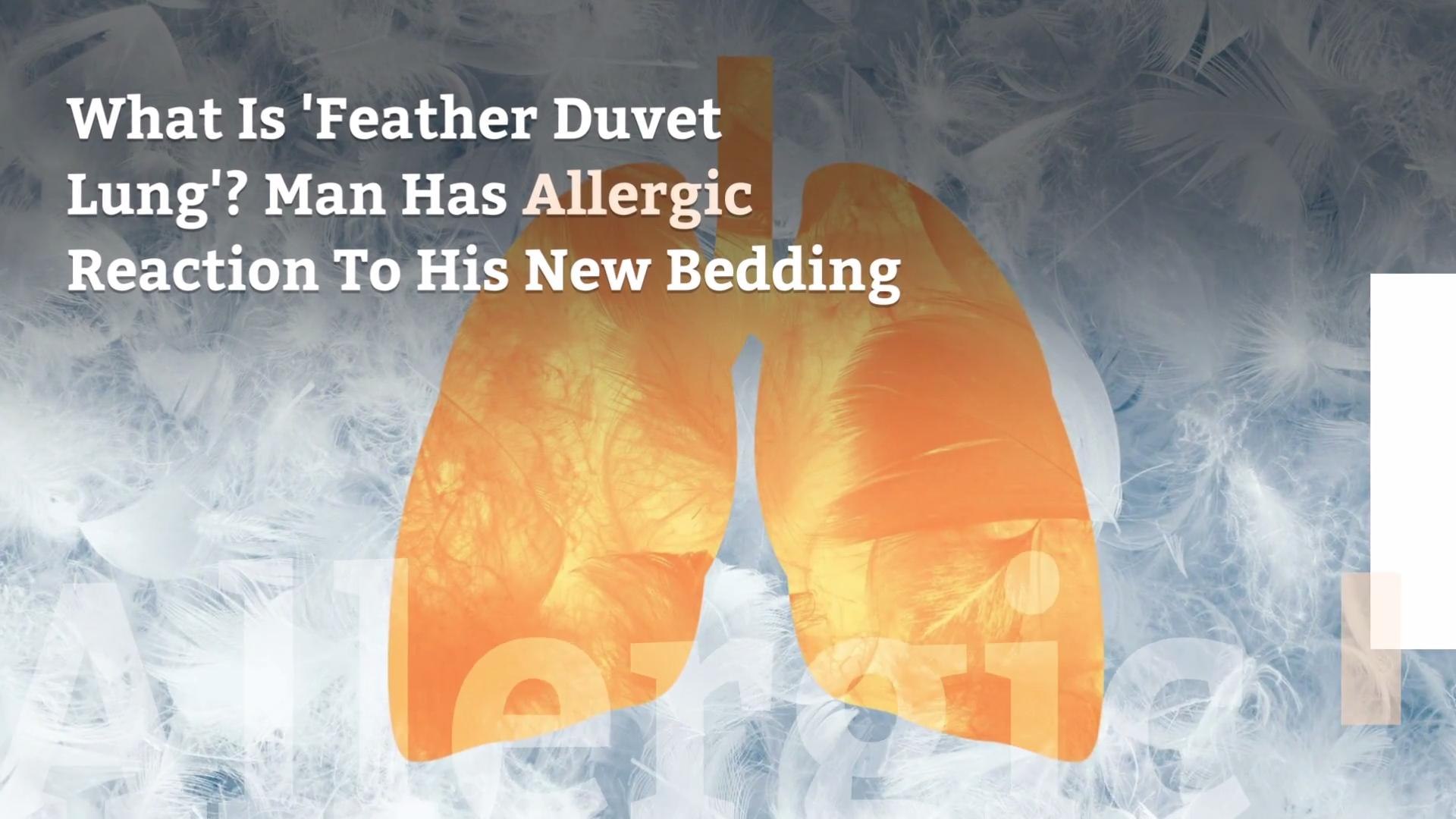 What Is Feather Duvet Lung Man Has Allergic Reaction To His New