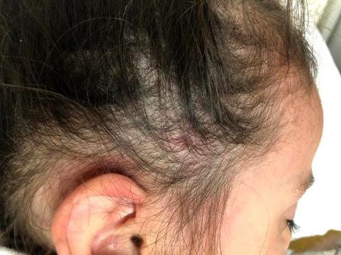 2,5 yaşındaki kız çocuğu, anaokulunda yaşıtları tarafından dövüldü