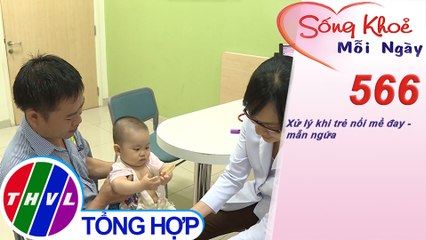 Xử lý khi trẻ nổi mề đay - mẫn ngứa | Sống khỏe mỗi ngày - Kỳ 566