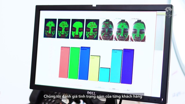 Chia Sẻ Bí Quyết Trị Sạch Nám I Phác Đồ Melas Ruby[Thẩm mỹ viện Bích Nguyệt]