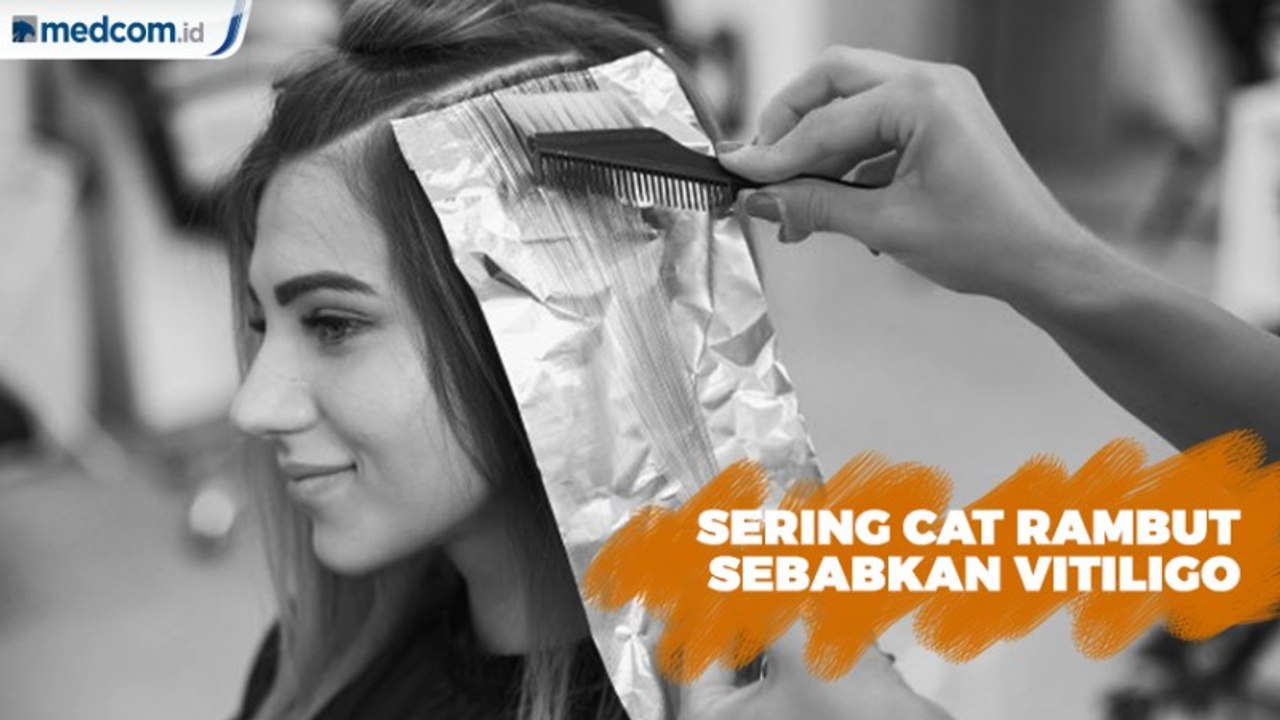 Sering Cat Rambut Sebabkan Vitiligo