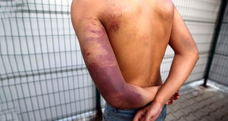 Yunan askerleri, göçmenleri silahla dövüp Türkiye'ye gönderdi