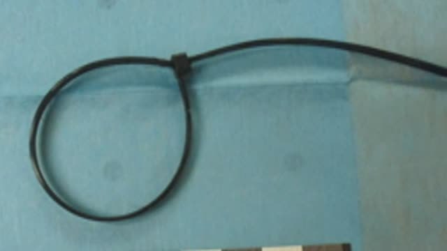 Los forenses concluyen que el Chicle estranguló a Diana con la brida pero no prueban agresión sexual