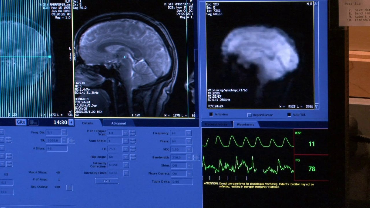 Meditation's Impact on the Brain | Documentary Clip