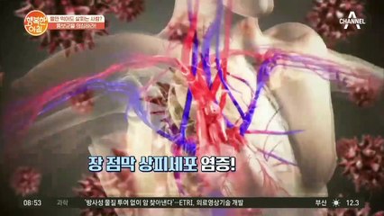 [장 건강 지키는 법] 장내 유익균을 늘려야 비만을 막는다!!