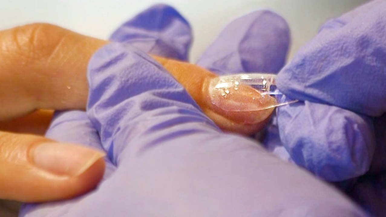 Are gel nail extensions less damaging than acrylics? video Dailymotion