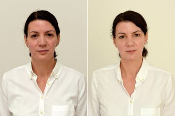 El milagro de beber tres litros de agua diariamente durante un mes