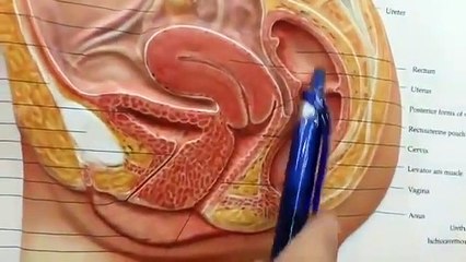 Para Mabilis Mabuntis Retroverted Uterus - ni Dr Catherine Howard