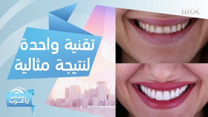 لتجنب أي مشكلة أثناء تجميل أسنانك.. اتبع هذه النصائح