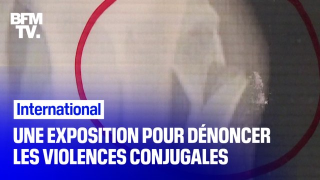 Une exposition dans un hôpital de Milan pour dénoncer les violences conjugales