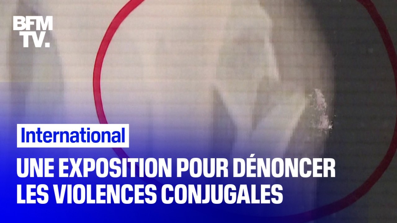 Une exposition dans un hôpital de Milan pour dénoncer les violences conjugales