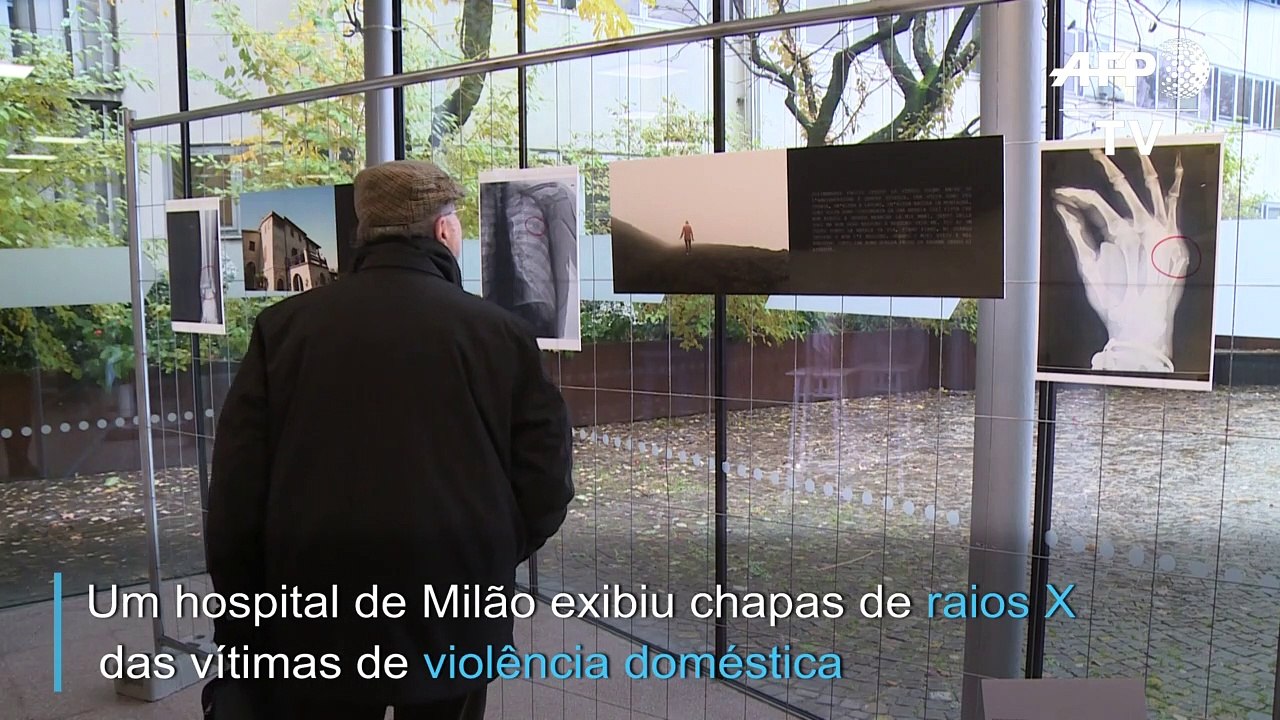 Exibição utiliza raios X de vítimas de violência doméstica