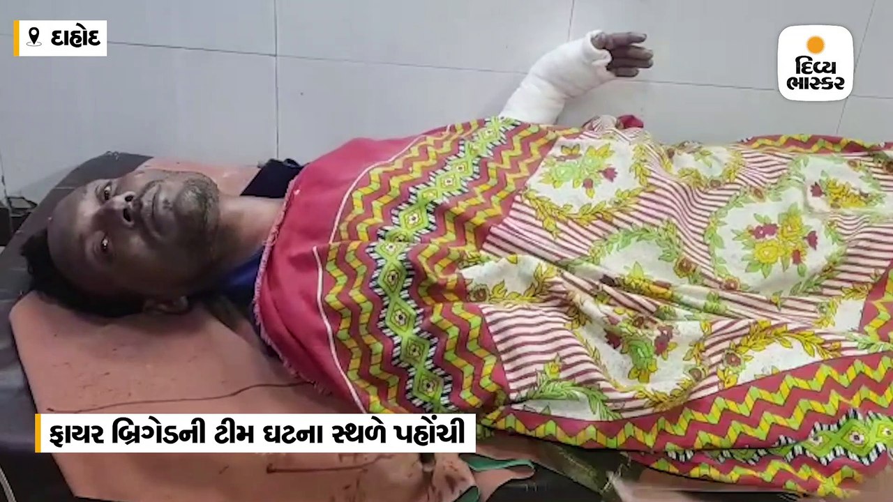 દાહોદમાં ગેસ સિલિન્ડર લીકેજ થતાં આગ લાગી