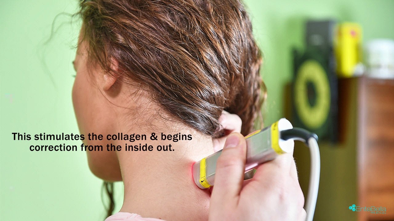 Best Aesthetic Center in Peoria to Treat Vascular & Pigmented Lesions