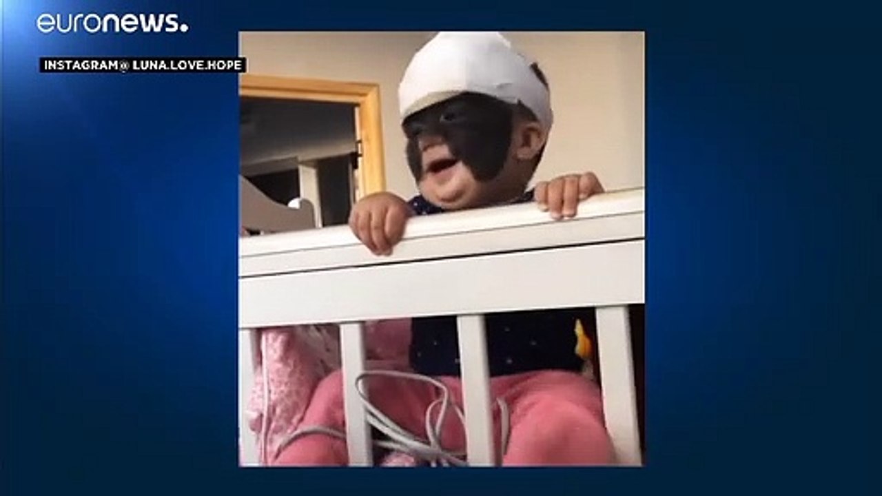 Kind mit 'Batman-Maske': Luna aus Florida in Russland behandelt