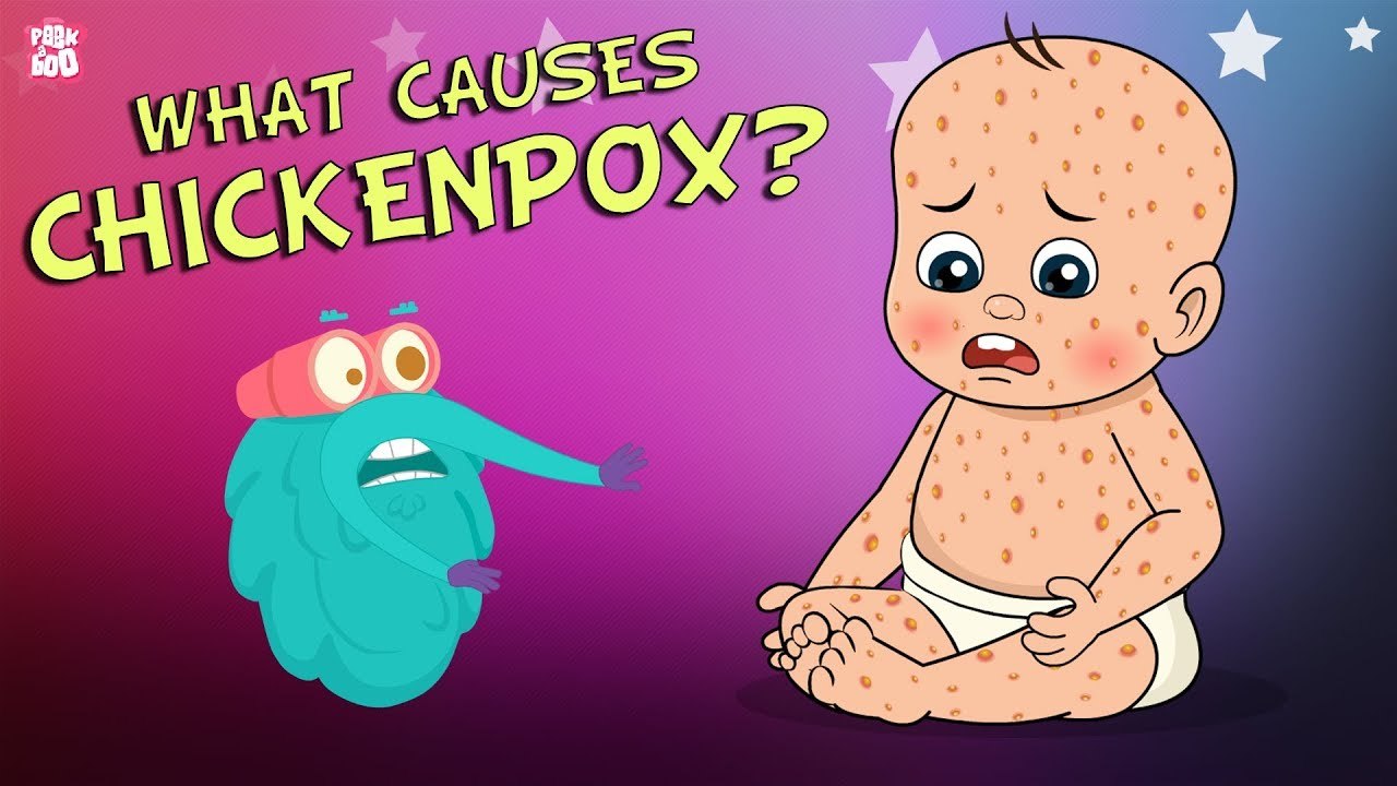 What Causes Chickenpox? | The Dr. Binocs Show | Best Learning Videos For Kids | Peekaboo Kidz