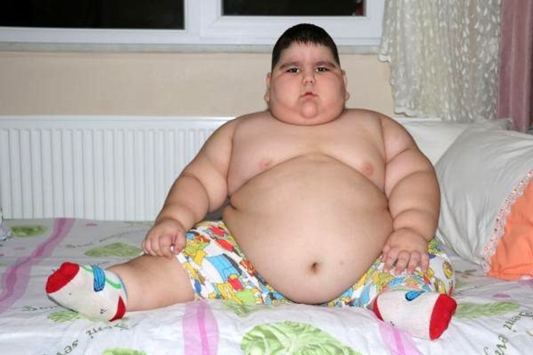 Hastalığı sebebiyle kullandığı ilaçlar yüzünden sürekli kilo alıyor: 4 yaşında tam 70 kilo