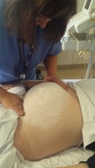 External Cephalic Version at 40 Weeks