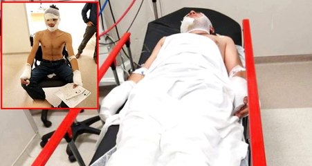 Kız kardeşini kaçıran kişinin evine yakmak isteyen ağabey, kendini yaktı