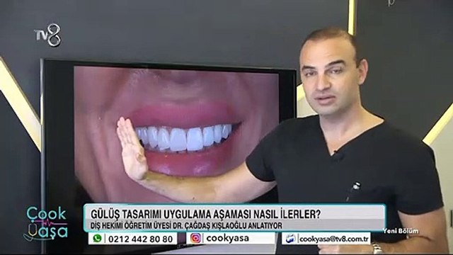Gülüş Tasarımı: Doğal ve sade mi? Yoksa cesur ve iddialı mı?