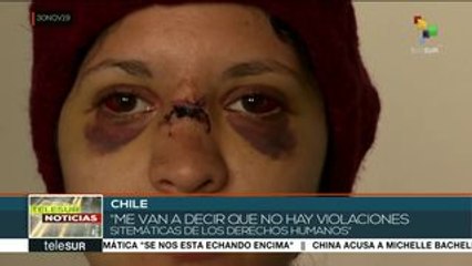 teleSUR Noticias: 11 días de protestas en Colombia