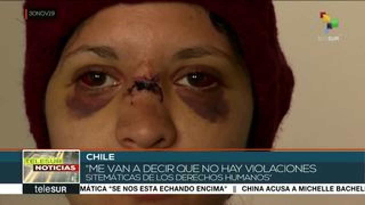 teleSUR Noticias: 11 días de protestas en Colombia