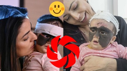Une mère fait des câlins à sa fille après que les médecins lui aient enlevé une partie de sa tache d