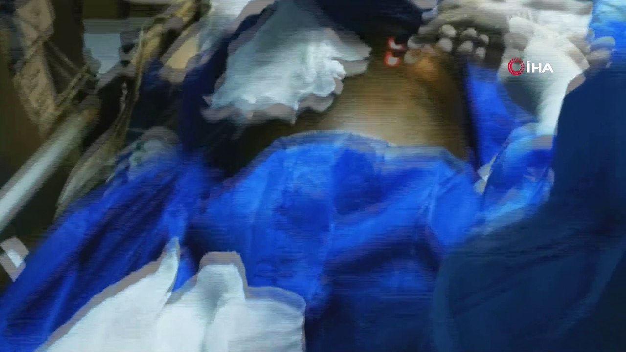 Yemek borusu kapandığı için beslenemeyen Nijeryalı hasta Türkiye’de sağlığına kavuştu