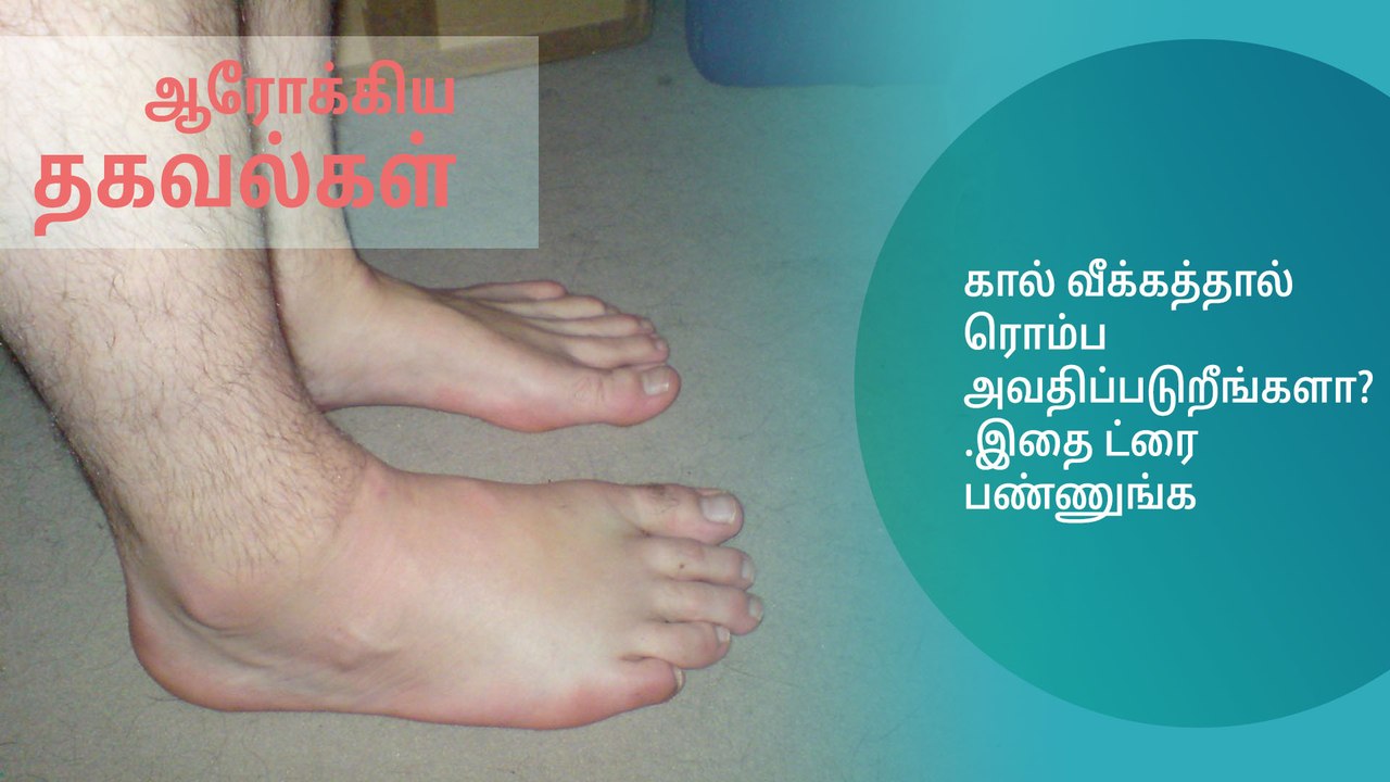 கால் வீக்கத்தால் ரொம்ப அவதிப்படுறீங்களா? .இதை ட்ரை பண்ணுங்க..!