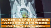 Cancer de la prostate : messieurs, rassurez-vous, ce test va remplacer le toucher r...