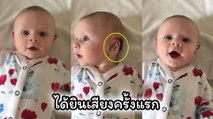ทารกหูหนวกวัย 4 เดือน ได้ยินเสียงเป็นครั้งแรก ด้วยเครื่องช่วยฟัง