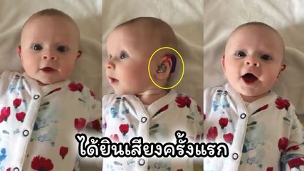 ทารกหูหนวกวัย 4 เดือน ได้ยินเสียงเป็นครั้งแรก ด้วยเครื่องช่วยฟัง