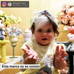 Adorable bebé nace con la misma condición que su madre en el cabello